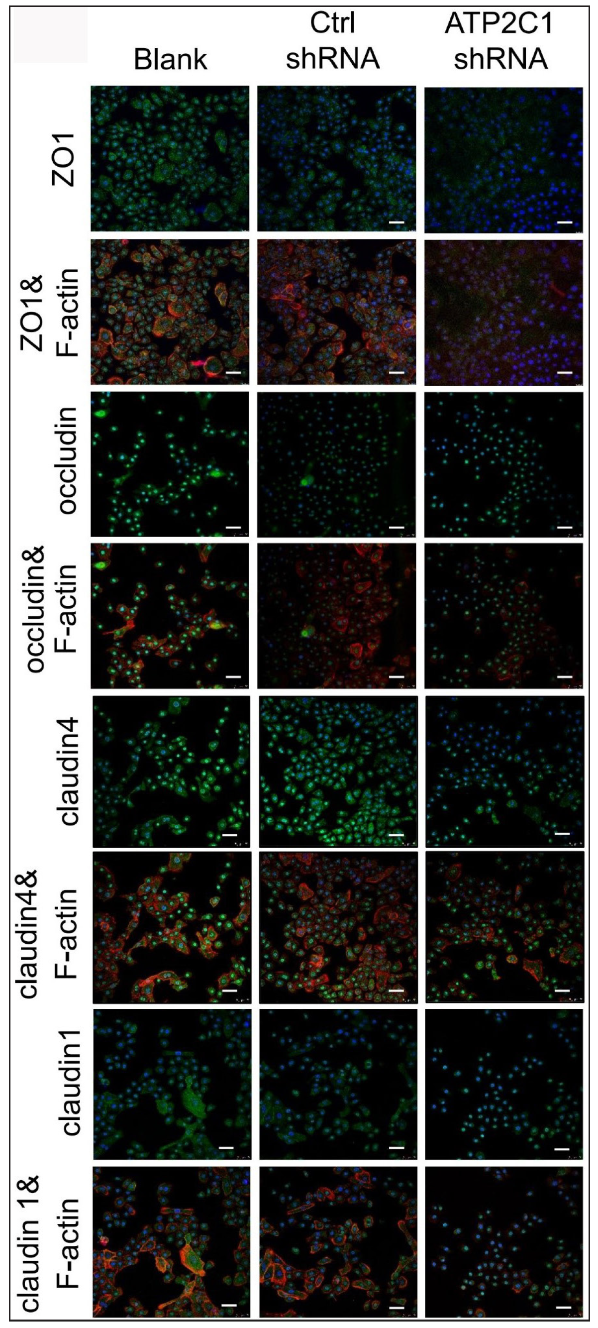 The expressions of tight junction proteins after shRNA transfection in keratinocytes. Immunofluorescence was performed to detect the expression of tight junction proteins in the cells. ATP2C1, Adenosine Triphosphatase calcium-transporting type 2C member 1 gene; ZO-1, zonula occludens protein 1. Scale bar = 50 µm.