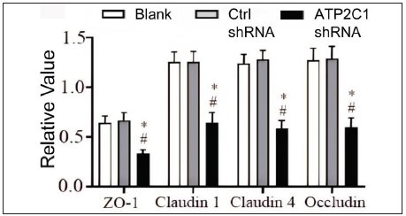 The protein levels of tight junction proteins in keratinocytes were determined by Western blotting technique following shRNA transfection. The ImageJ software measured the intensity of protein bands. Data were from three independent experiments. ATP2C1, Adenosine Triphosphatase calcium-transporting type 2C member 1 gene; ZO-1, zonula occludens protein 1. *p < 0.05, compared to the blank groups; #p < 0.05, compared to the control shRNA group.