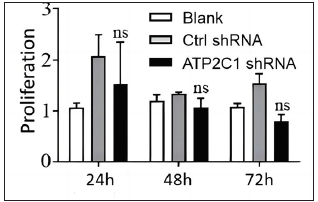 The effect of ATP2C1 gene knockdown on proliferation was measured by cell counting kit-8 (CCK-8). ns, no statistical difference. ATP2C1, Adenosine Triphosphatase calcium-transporting type 2C member 1 gene.