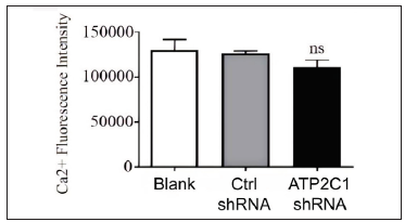 The effect of ATP2C1 gene knockdown on intracellular Ca2+ concentration was assessed using Fluo-3 Acetoxymethyl Ester (fluo-3 AM). ns, no statistical difference. ATP2C1, Adenosine Triphosphatase calcium-transporting type 2C member 1 gene.