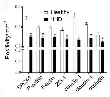 SPCA1, cytoskeletal, and tight junction proteins are poorly expressed in the skin lesions of patients with HHD. ImageJ and GraphPad Prism 8.0 software determined the intensities of protein expressions. Scale bar = 50 µm. *p < 0.05, compared to the healthy donors. SPCA1, Secretory pathway Ca2+/Mn2+ Adenosine Triphosphatase pump type 1; HHD, Hailey–Hailey disease; ZO-1, zonula occludens protein 1.