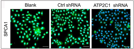 Successful transfection of ATP2C1 shRNA in keratinocytes. Immunofluorescence was performed to detect the SPCA1 expression. ATP2C1, Adenosine Triphosphatase calcium-transporting type 2C member 1 gene; SPCA1, Secretory pathway Ca2+/Mn2+ Adenosine Triphosphatase pump type 1.