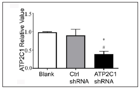 Transfection of ATP2C1 shRNA in keratinocytes. The mRNA expression of ATP2C1 was determined in cells. *p < 0.05, compared to the blank groups; #p < 0.05, compared to the control shRNA group. ATP2C1, Adenosine Triphosphatase calcium-transporting type 2C member 1 gene.