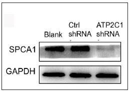 Successful transfection of ATP2C1 shRNA in keratinocytes. The expression of SPCA1 was analysed by Western blotting technique. ATP2C1, Adenosine Triphosphatase calcium-transporting type 2C member 1 gene; SPCA1, Secretory pathway Ca2+/Mn2+ Adenosine Triphosphatase pump type 1; GAPDH, glyceraldehyde-3-phosphate dehydrogenase.