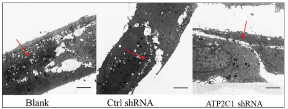 Successful transfection of ATP2C1 shRNA in keratinocytes. Electron microscopic structure of keratinocytes after ATP2C1 gene knockout. Red arrows represent intercellular space. Scale bar = 2.5 µm. ATP2C1: Adenosine Triphosphatase calcium-transporting type 2C member 1 gene.