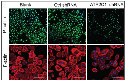 The expressions of P-cofilin and F-actin are reduced after shRNA transfection in keratinocytes. Immunofluorescence was performed for the P-cofilin and F-actin expression. ATP2C1, Adenosine Triphosphatase calcium-transporting type 2C member 1 gene. Scale bar = 20 µm.