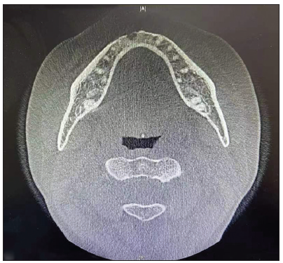 CBCT scan with an axial view of the patient (1a).