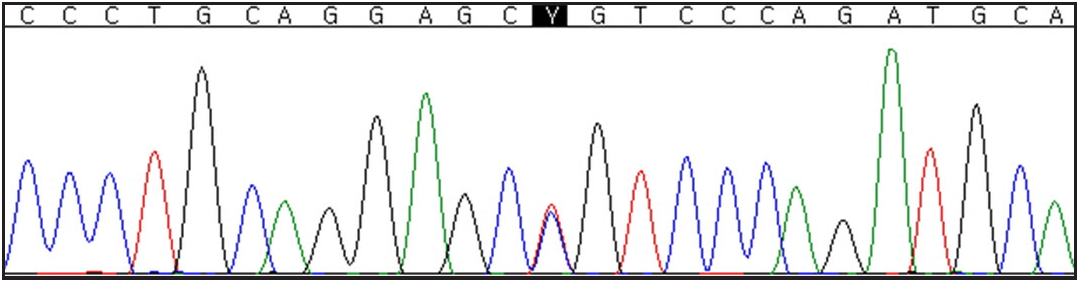 Chromatogram of Sanger sequencing showing a KRT5 heterozygous mutation c.932T>C that led to p.(Leu311Pro) missense variant