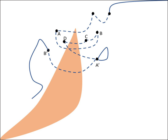 After passing through points A, B and C, the needle re-enters the skin through point D and exits the far contralateral edge (point A’) in a deeper plane, about 1 cm from the previous vertical mattress. It again exits at the far opposite end (point B’) and the same process is followed through the length of the wound.