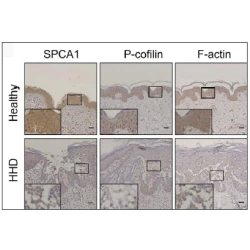 Article figure