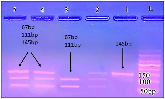 Agarose gel electrophoresis analysis of TLR9 rs18708 in the patient group; lanes 1 (CC genotype produced only one 145 bp band); lane: 2, 5, 6 (CT genotype produced 3 bands: 145, 111 and 67 bp); lane:3 (TT genotype 111, and 67 bp bands); L: ladder 50 bp.