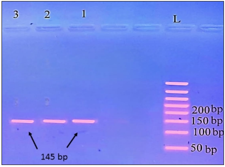 Agarose gel electrophoresis analysis of TLR9 rs187084 in control subjects; lanes 1, 2, 3 (CC genotype produced only one 145 bp band), L: ladder 50 bp.