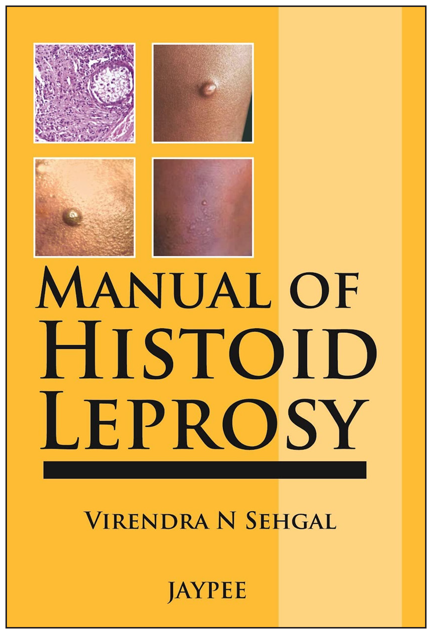 Cover of Manual of Histoid Leprosy by V.N. Sehgal (2013).