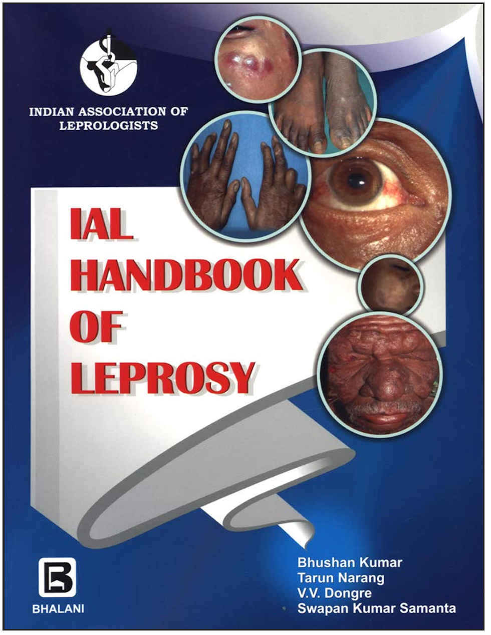Cover of IAL Handbook of Leprosy (First Edition, 2018).