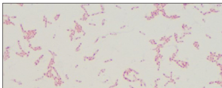 Image showing classical safety pin appearance of the Gram negative organism. [Gram stain, 100x].