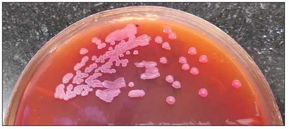 Pink colonies of Burkholderia pseudomellie on MacConkey agar.