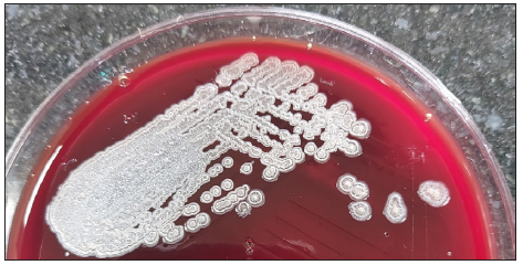 Cream-coloured colonies of Burkholderia pseudomellie on blood agar.