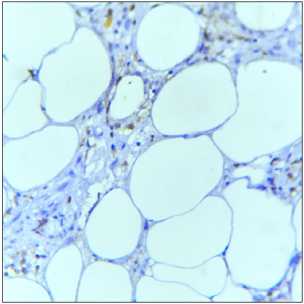 The section shows few CD4+ T cells. (IHC with DAB staining: 40x, Classic EN).