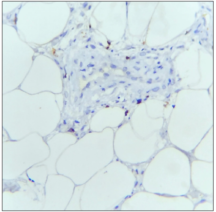 The section shows few CD8+ T cells. (IHC with DAB staining: 40x, Classic EN).