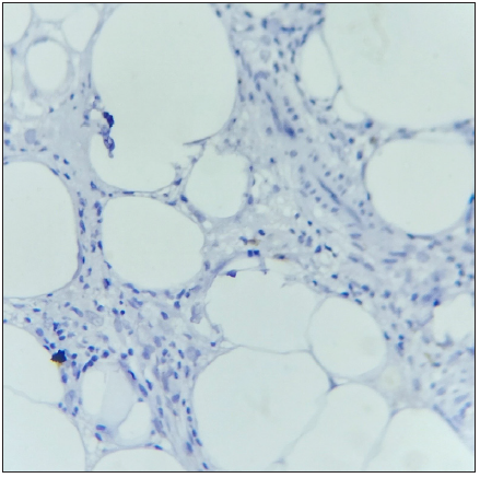 The section shows absence of CD56+ NK cells. (IHC with DAB staining: 40x, Classic EN).