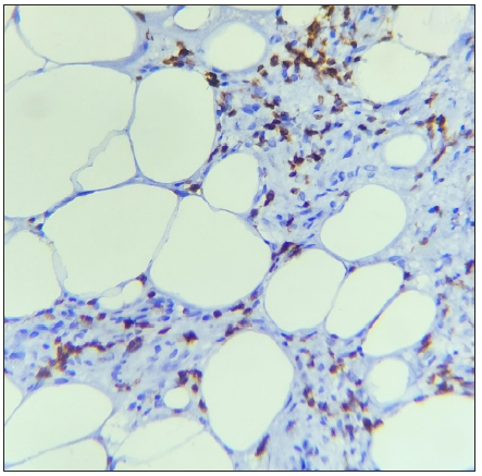 The section shows scattered CD3+ T cells. (IHC with DAB staining: 40x, Classic EN).