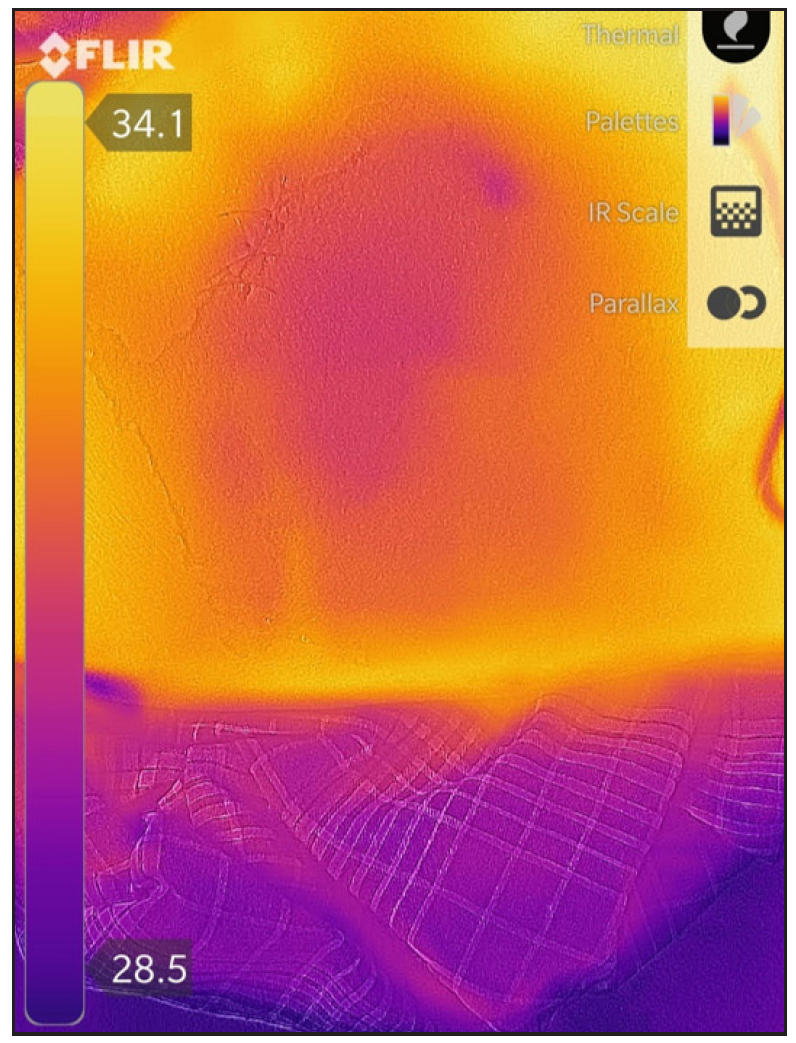 Thermographic image of the right buttock on day 3 of triple therapy showing a cold spot (red to dark blue) (temperature gradient- 4.2°C)