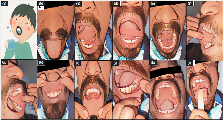 Images used in oral cavity photography instruction videos demonstrating (2a) rinsing mouth, (2b) upper surface of tongue, (2c) left lateral border of tongue, (2d) right lateral border of tongue, (2e) ventral surface of tongue and floor of mouth, (2f) right buccal mucosa, (2g) left buccal mucosa, (2h) upper lip and upper gingival mucosa, (2i) lower lip and lower gingival mucosa, (2j) left lower lateral gingivo buccal sulcus, the same way can be followed for right lower lateral gingivo buccal sulcus, (2k) hard and soft palate, (2l) posterior wall of pharynx.