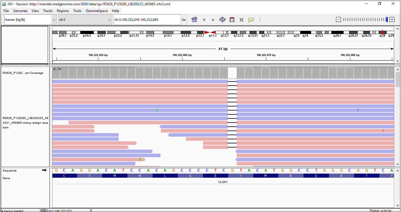 Integrated genome viewer image for the base-pair deletion in Exon 1 of the CLDN1 gene (c.141del).