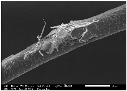 Scanning electron microscopic image of hair showing fractured cortex.
